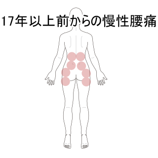 １７年前から年に何度も寝たきりになってしまう原因不明の腰痛｜脚・足