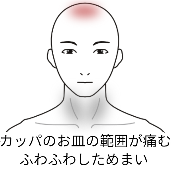 頭頂部の頭痛と 頚を左右に振ると出現するめまい めまい 頭痛のツボ ツボネット 鍼灸の症例が検索できるツボ辞典