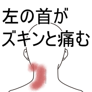 左の首がズキンと痛む 頚痛のツボ ツボネット 鍼灸の症例が検索できるツボ辞典