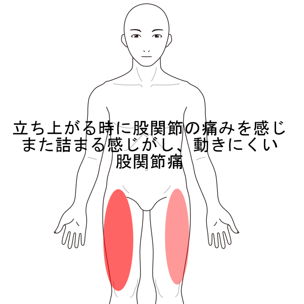 股関節が詰まっている様な感じがし痛みが出る股関節痛 脚の重だるさ 股関節痛のツボ ツボネット 鍼灸の症例が検索できるツボ辞典