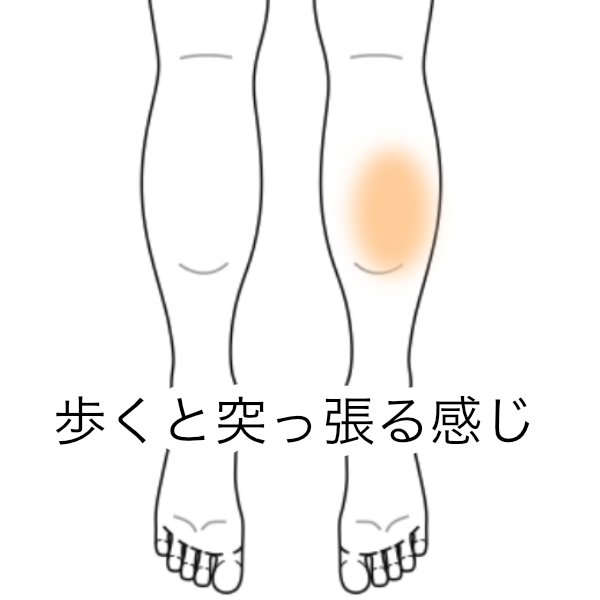 歩く時 ふくらはぎに違和感がある 下腿の痛みのツボ ツボネット 鍼灸の症例が検索できるツボ辞典