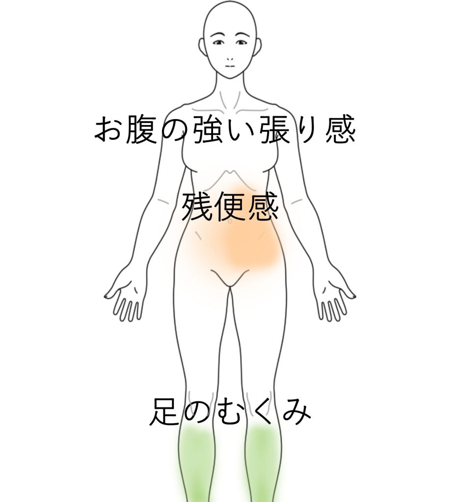 排便してもスッキリせず お腹が張って苦しい 便秘になってから足が浮腫む 便秘のツボ ツボネット 鍼灸の症例が検索できるツボ辞典