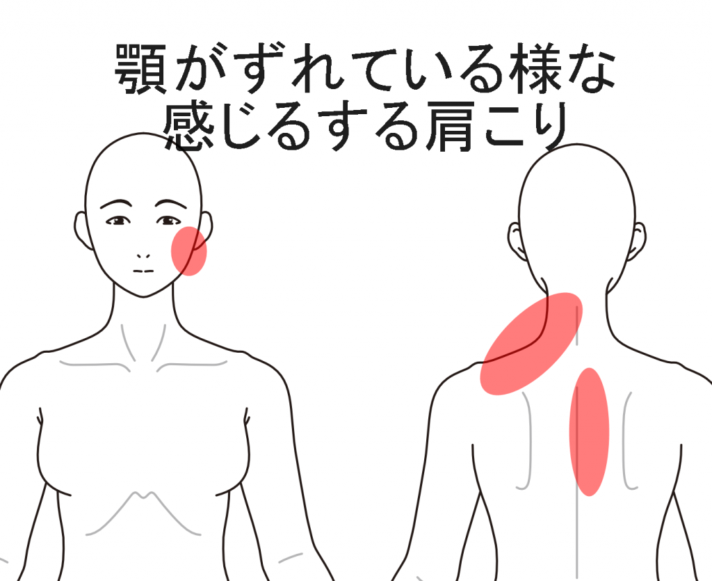 関節 痛 症 額