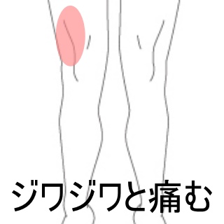 膝の外側の痛み 違和感 大腿の痛み 膝痛のツボ ツボネット 鍼灸の症例が検索できるツボ辞典