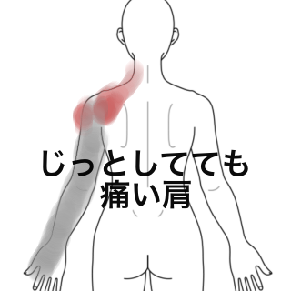重い 左肩 肩の痛みが左側や首からくる場合は要注意！原因や対策を紹介します。