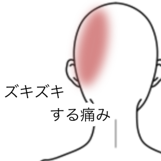 頭がピリピリ痛む 後頭神経痛 に鍼灸が効果的な理由 ツボネット 鍼灸の症例が検索できるツボ辞典