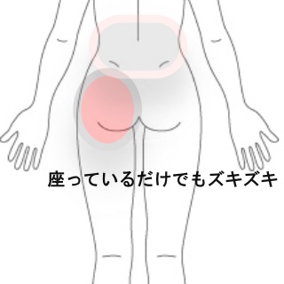 打撲後から生じた臀部痛 腰痛 臀部痛 腰痛のツボ ツボネット 鍼灸の症例が検索できるツボ辞典