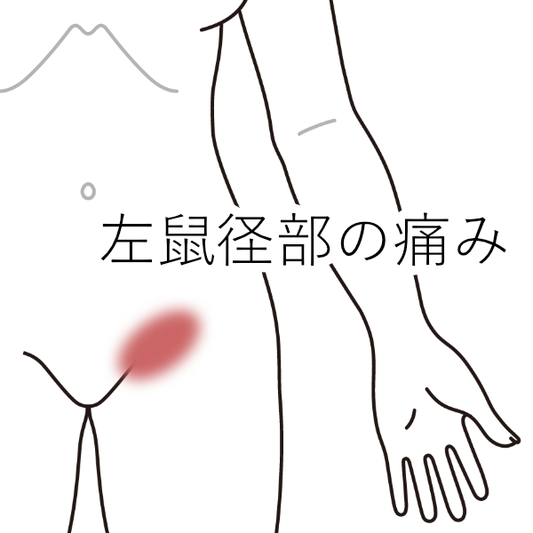 痛み 鼠径 部 女性の左側の鼠径部の痛み：原因、治療法など