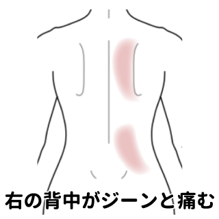 呼吸や しゃっくりで背部が痛む 背部痛 腰痛のツボ ツボネット 鍼灸の症例が検索できるツボ辞典