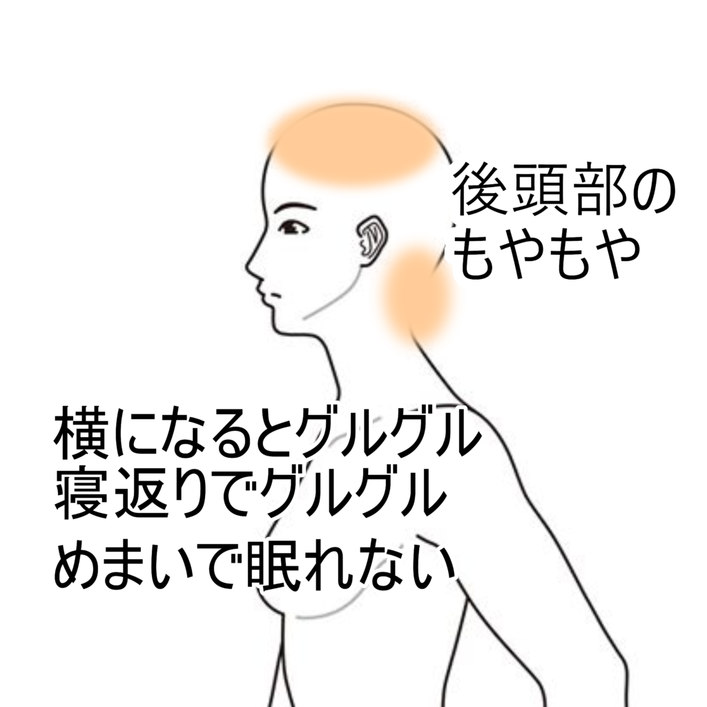 横 に なると めまい ふわふわ