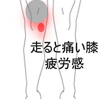 走ると膝の内側が痛み太ももに疲労感が出る 脚の重だるさ 膝痛のツボ ツボネット 鍼灸の症例が検索できるツボ辞典