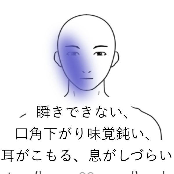 瞬きできない 口角下がり味覚鈍い 耳がこもる 呼吸がしずらい 顔面神経麻痺のツボ ツボネット 鍼灸の症例が検索できるツボ辞典