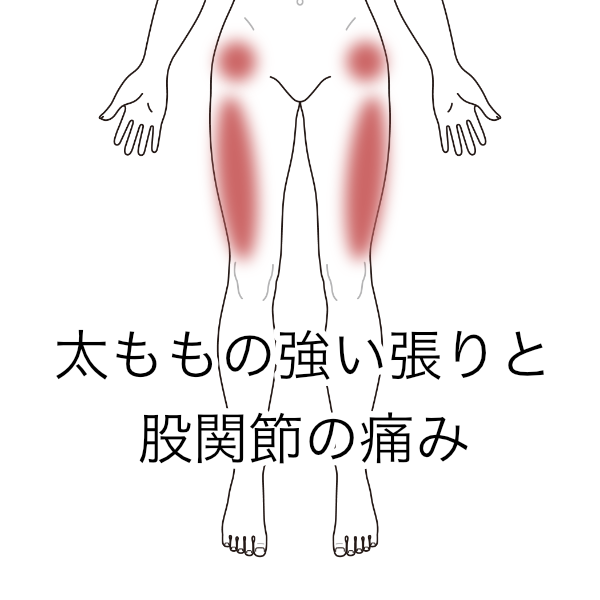 太ももの強い張りと股関節の痛み 大腿の痛み 股関節痛のツボ ツボネット 鍼灸の症例が検索できるツボ辞典