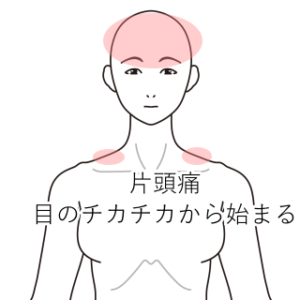 吐き気まで催す頭痛|肩こり・首こり、頭痛のツボ|ツボネット 鍼灸の症例が検索できるツボ辞典