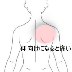仰向けで寝ると背中が痛くなる|背部痛のツボ|ツボネット 鍼灸の症例が検索できるツボ辞典