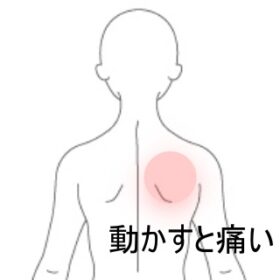 肩甲骨を中心とした痛み |背部痛のツボ|ツボネット 鍼灸の症例が検索できるツボ辞典