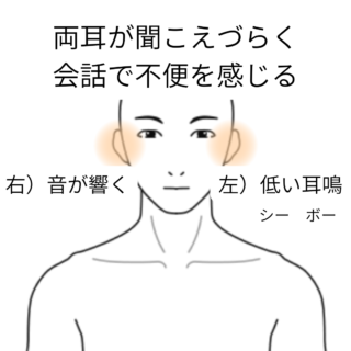 低音型感音性難聴と診断された耳の症状
