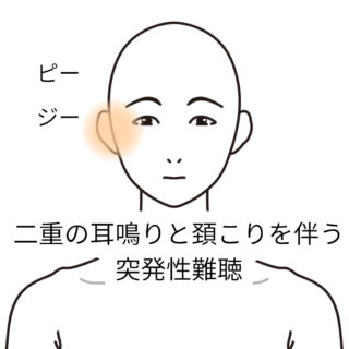 鍼灸症例「二重の耳鳴りと頚こりを伴う突発性難聴」症例（養気院／群馬県伊勢崎市）