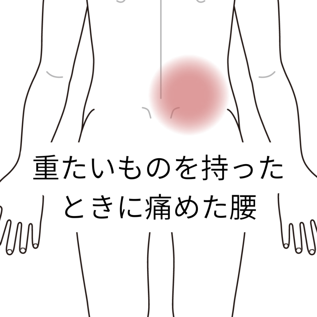 腰痛・腰下肢痛診療のキーポイント 腰痛・腰下肢痛診療のキーポイント | 森本昌宏、橋爪圭司、山口