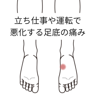 立ち仕事や運転で悪化する足底の痛み