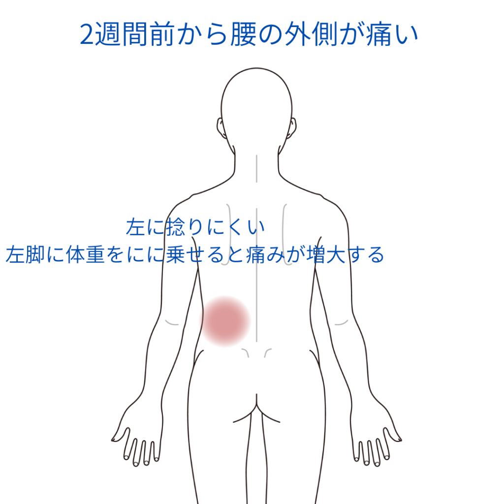 腰痛・腰下肢痛診療のキーポイント 腰痛・腰下肢痛診療のキーポイント | 森本昌宏、橋爪圭司、山口