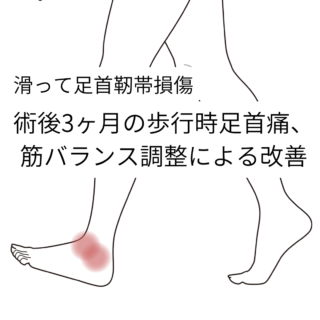 鍼灸症例「術後3ヶ月の歩行時足首痛、筋バランス調整による改善（養気院／群馬県伊勢崎市）