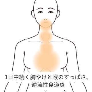 鍼灸症例「1日中続く胸やけと喉のすっぱさ、逆流性食道炎」（養気院／群馬県伊勢崎市）