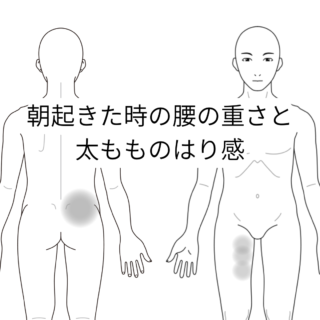 症例_朝起きた時の腰の重さと太もものはり感(カポス)