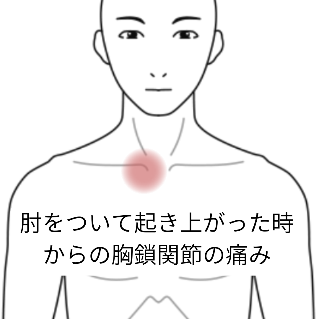 鍼灸症例「肘をついて起き上がった時からの胸鎖関節の痛み」（養気院／群馬県伊勢崎市）