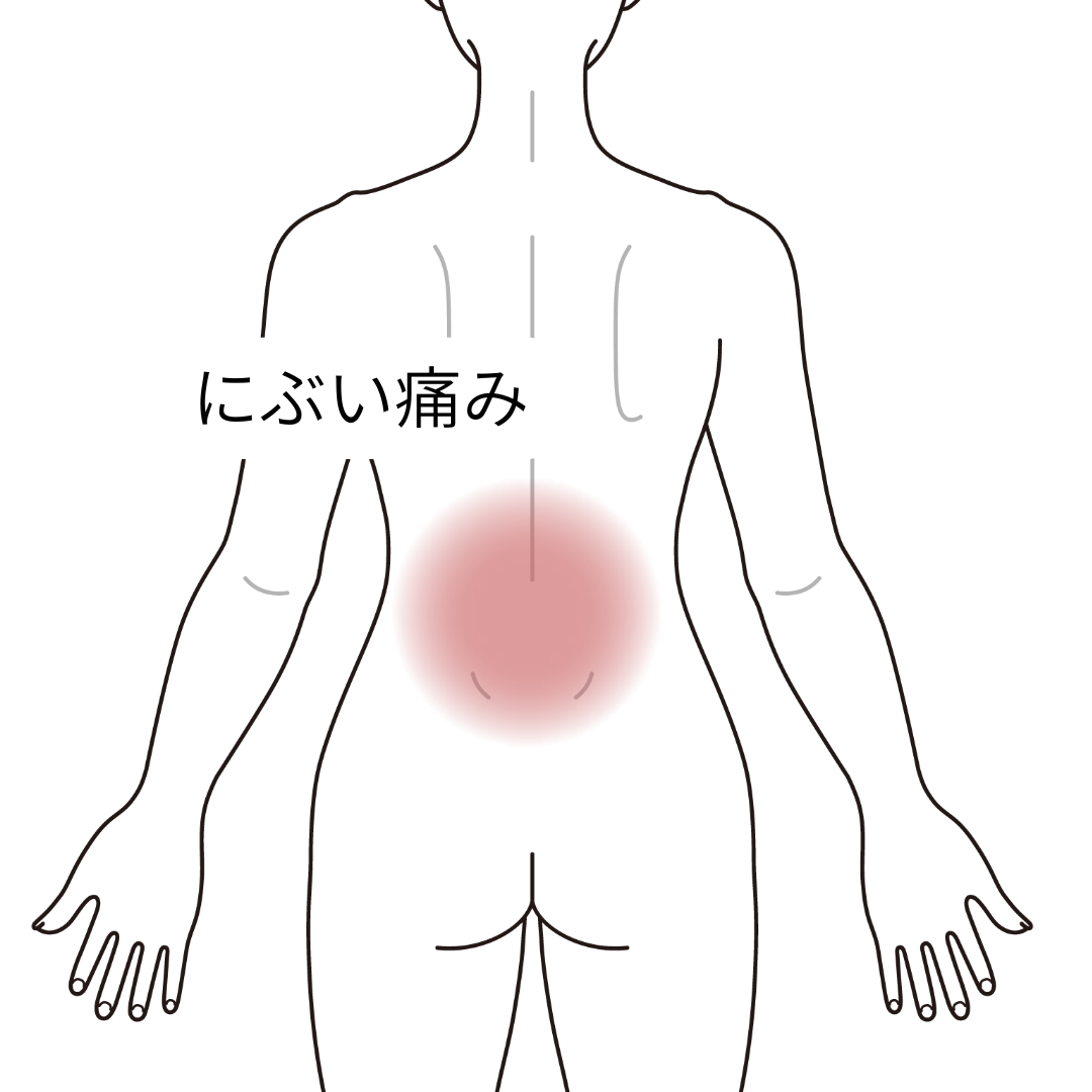 鍼灸　腰痛を示す図