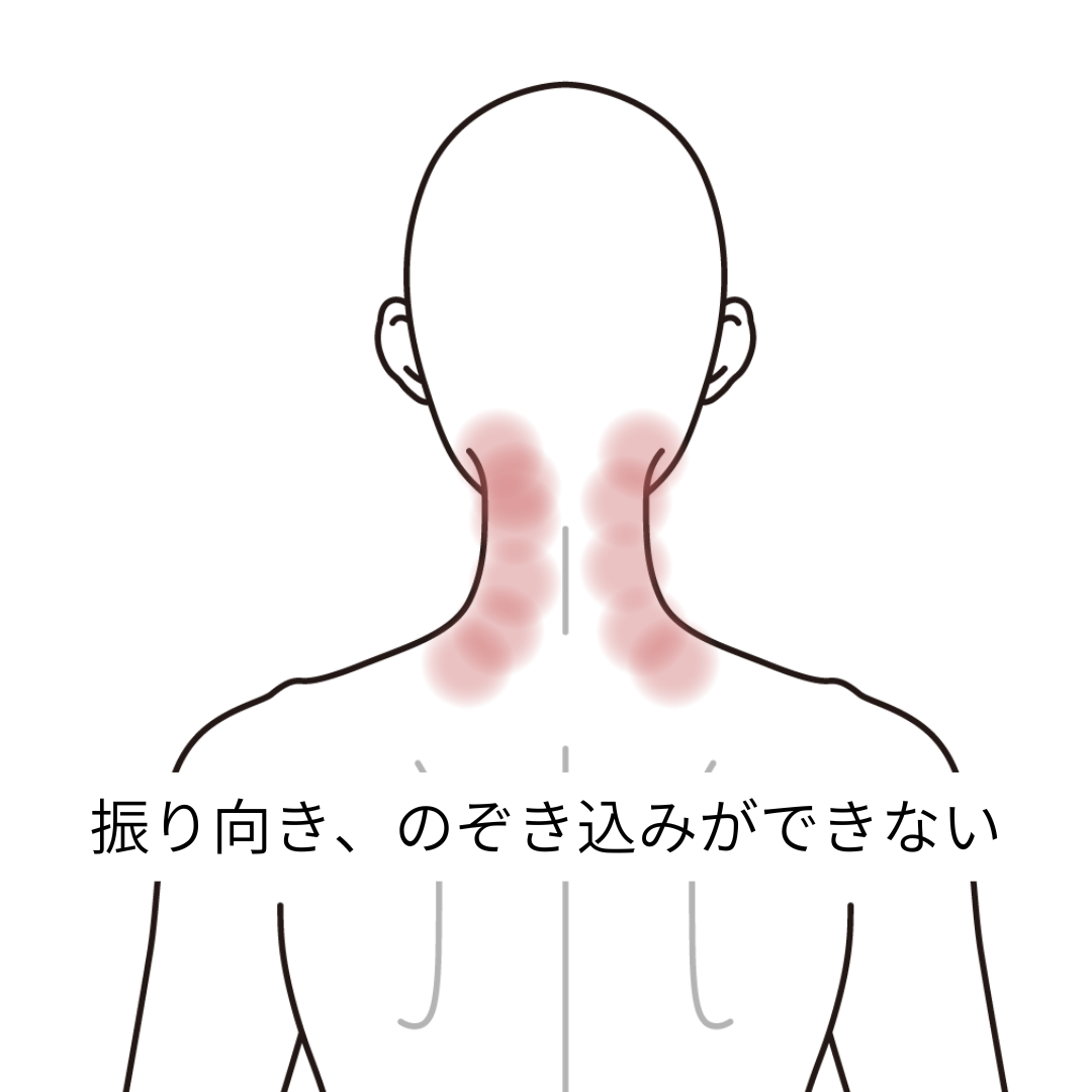 首の痛む場所を示す図