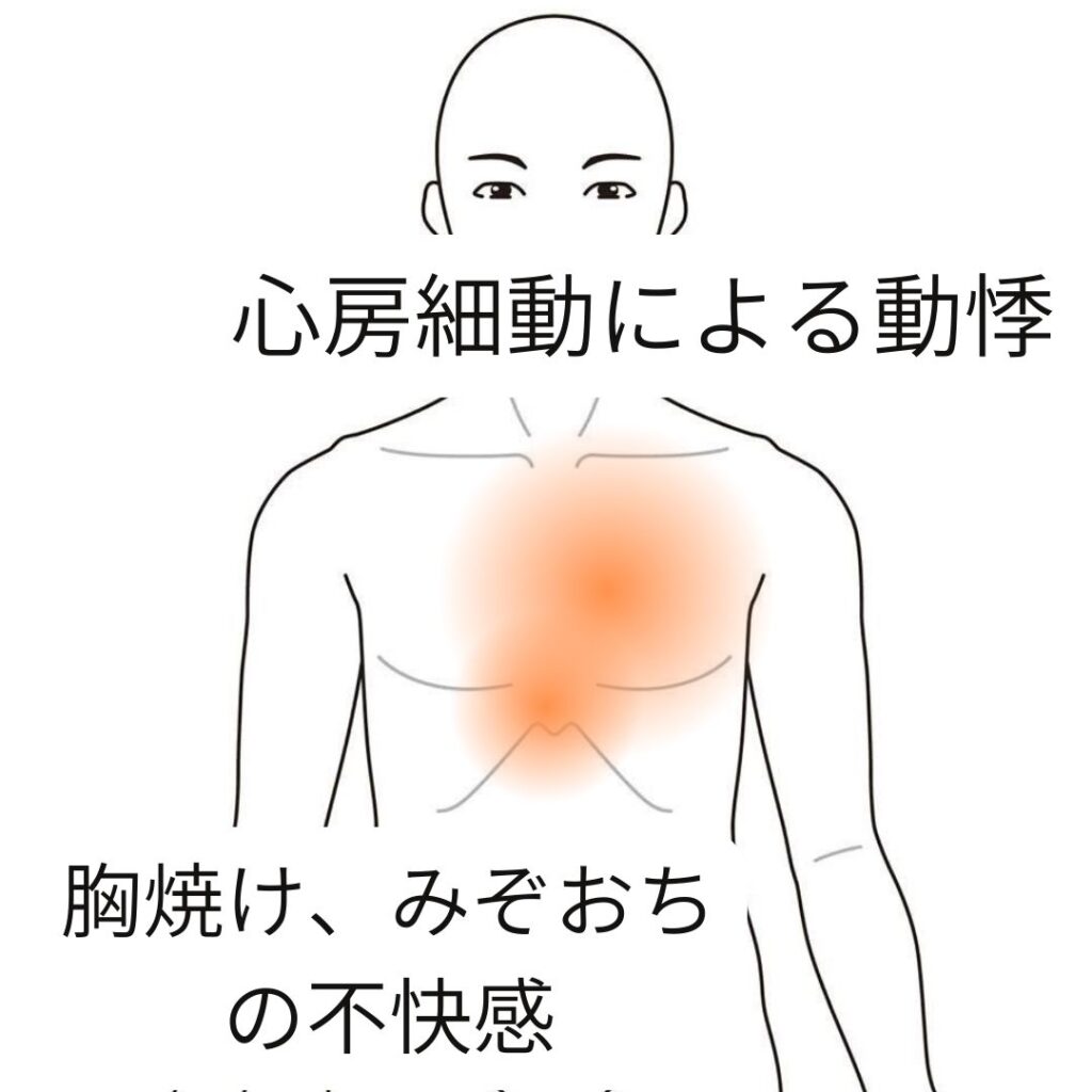 不整脈 の ツボ
