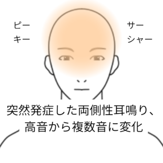 鍼灸症例「突然発症した両側性耳鳴り、高音から複数音に変化」（養気院／群馬県伊勢崎市）