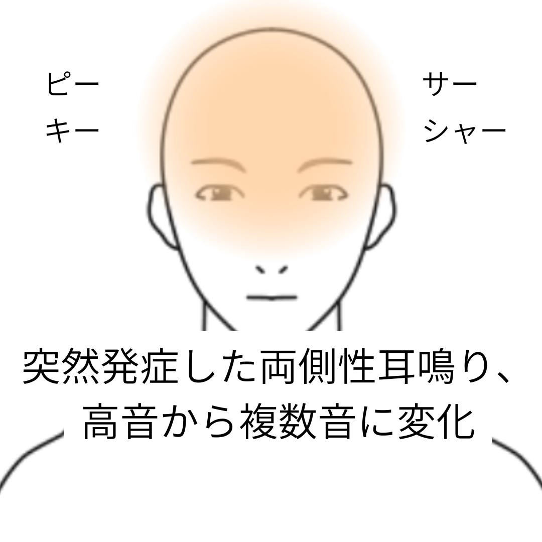 鍼灸症例「突然発症した両側性耳鳴り、高音から複数音に変化」（養気院／群馬県伊勢崎市）