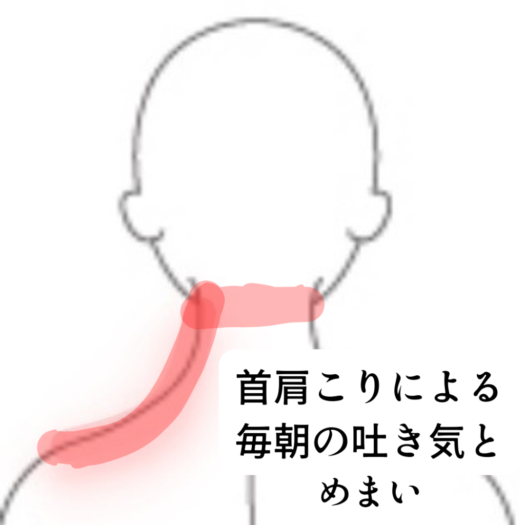首 こり 吐き気