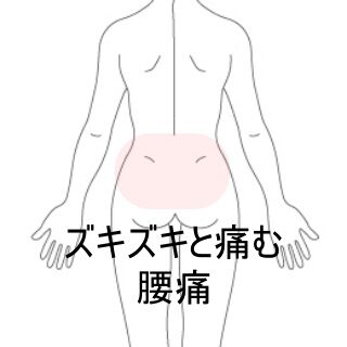 鍼灸の症例「動作時にズキズキ痛む腰痛の改善」(東室蘭駅)