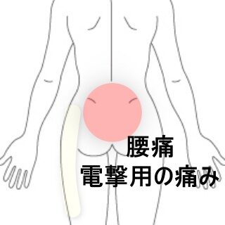 鍼灸の症例「腰臀部の電撃痛としびれの改善例」(東室蘭駅)