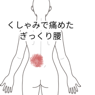鍼灸の症例「くしゃみで痛めたぎっくり腰」(勝田駅)