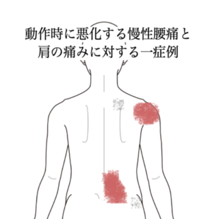 鍼灸の症例「動作時に悪化する慢性腰痛と肩の痛み」(島根県出雲市)