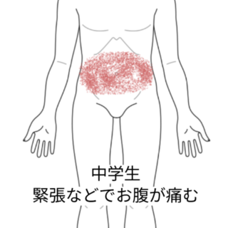 鍼灸の症例「ストレス緊張でお腹が痛い 学校生活に影響」(名鉄桜井駅/愛知県安城市)