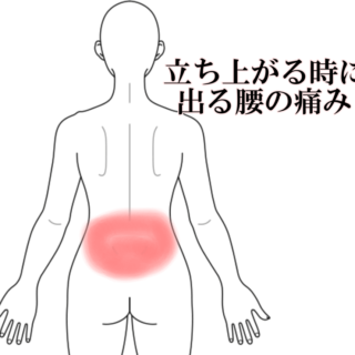 鍼灸の症例「立ち上がる時にでる腰の痛み」(愛知県あま市 / 名鉄七宝駅)