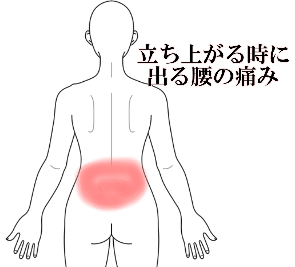 立ち上がる時にでる腰の痛み｜腰痛のツボ｜ツボネット 鍼灸の