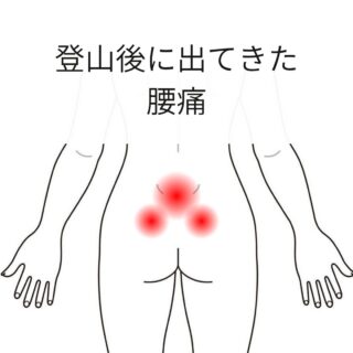 鍼灸の症例「登山後の腰痛」(世田谷区 三軒茶屋駅)