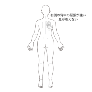 鍼灸の症例「息苦しさとふわふわするめまいの改善例」(有松駅)