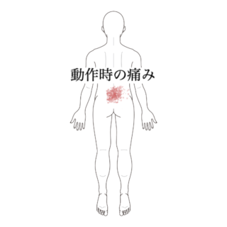 鍼灸の症例「動作時の腰の痛み」(沖縄県那覇市)