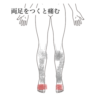 鍼灸の症例「両足をつくと痛む症状とふくらはぎの緊張の改善例」(都営新宿線 船堀駅 / 東京都江戸川区船堀)
