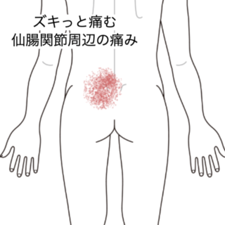鍼灸の症例「重たいものを持ったことで起きた仙腸関節周辺の痛み」(群馬県伊勢崎市)