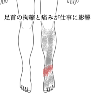 鍼灸の症例「足首の拘縮と痛みが仕事に影響」(都営新宿線 船堀駅 / 東京都江戸川区船堀)