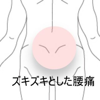 鍼灸の症例「陸上選手の腰臀部のズキズキ痛み」(東室蘭駅)