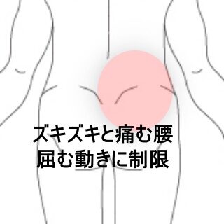 鍼灸の症例「重量物で起きたズキズキ腰痛で靴下が履けない」(東室蘭駅)